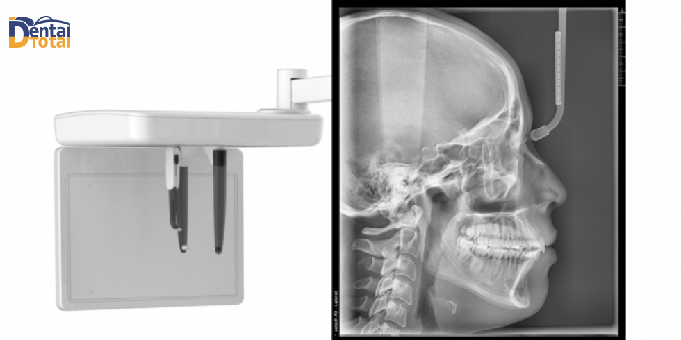 Tomógrafo Vatech A9: a Nova era da Eficiência na Radiologia Odontológica
